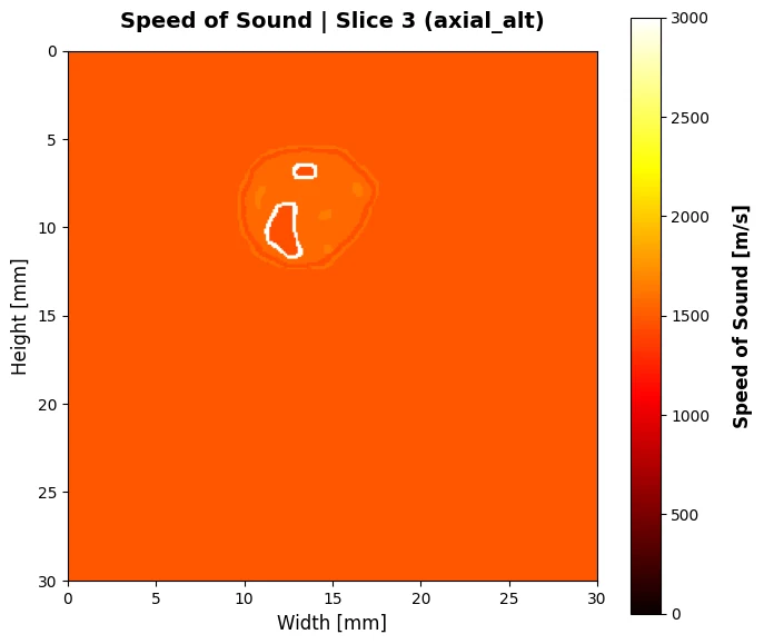Acoustic property map derived from a forearm slice