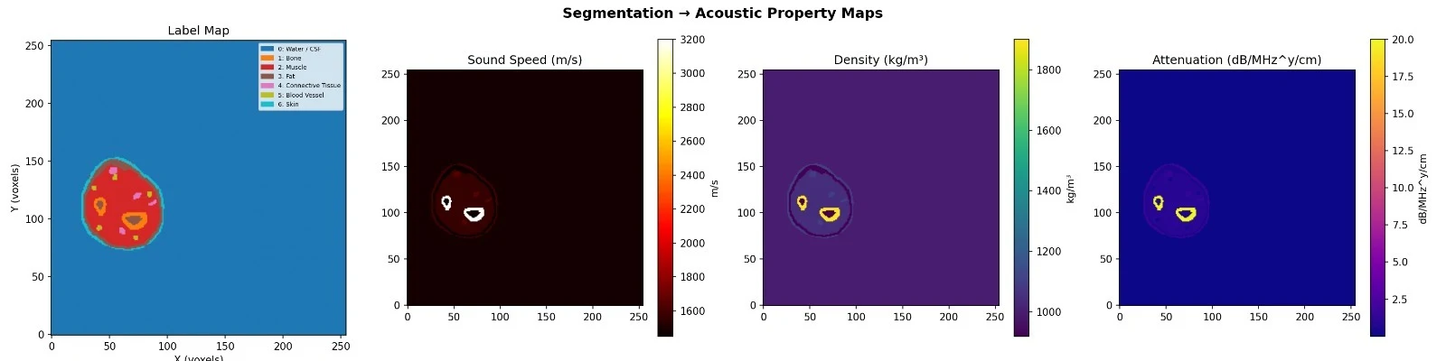Segmented forearm and maps of sound speed, density, and attenuation
